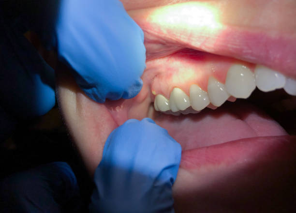 Best Weekend Emergency Dentist in Warren Af, WY