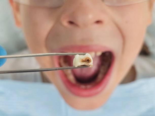 Best Cosmetic Emergency Dentistry in Warren Af, WY